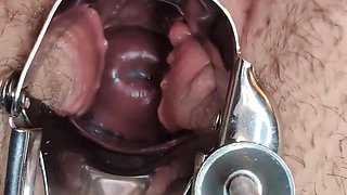 Pussy stretched, cumming & gaped open wide with a speculum at the end