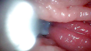 First time: An endoscope reveals the G-spot up close - without mountingl