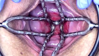 Japanese cervix fucking bottle and drinking of inside uterus