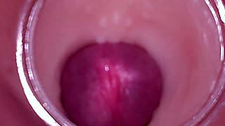 Female Insemination - Internal Camera Captures Deep Male Ejaculation