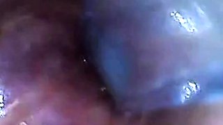 Endoscope POV Test Tube Cock Urethral Insertion