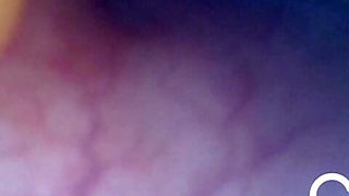 Anal Endoscope all the way in my Transverse Colon