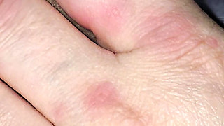 Step mom hand has allergy on step son dick while handjob
