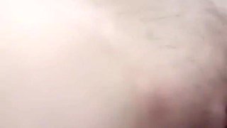 Margot Pees with a Big Bruise on Her Leg