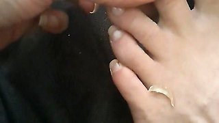 Long Toenail Clipping