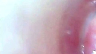 Endoscope POV: Test Tube Cock Urethral Insertion