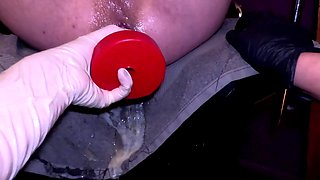 Epic Anal Fisting and Hankeys Red Snake Dildo Extreme Insertion