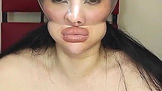 I Inflate the Condom on My Head Until It Bursts