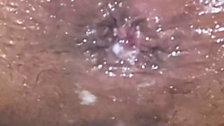 Trying to Get the Sperm Out, It Was so Deep That It Didn't Come Out