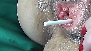 Lollipop