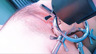 Speculum