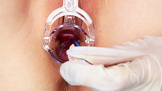 Uterus/cervix, Look How I Am Inside! Extreme Close-up