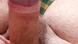 One year after surgery to remove phimosis and partial circumcision
